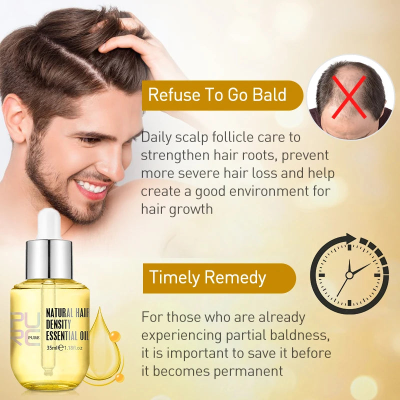 GingerMax Hair Regrowth Oil - Anti Hair Loss & Thickening Treatment for Men and Women