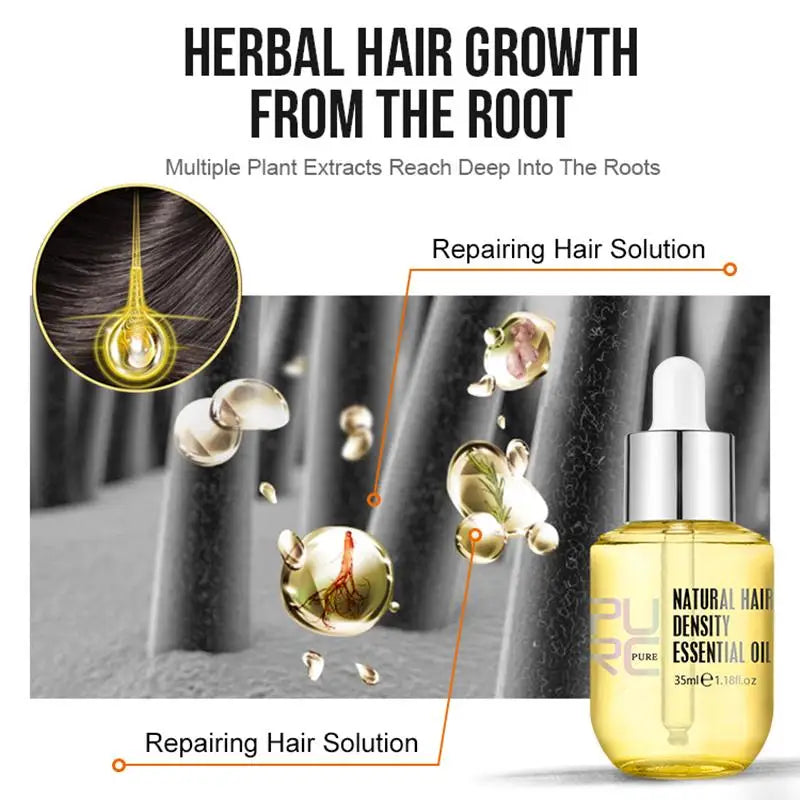 GingerMax Hair Regrowth Oil - Anti Hair Loss & Thickening Treatment for Men and Women